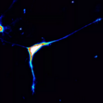 Immagine di un neurone derivato da cellule staminali acquisita con un microscopio confocale e tecniche di immunofluorescenza