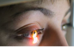 Immagine di un occhio durante un esame oculistico